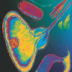 狼牌尿道膀胱镜图片展示